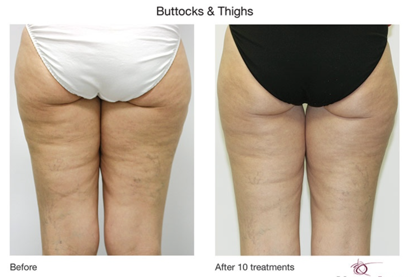 Screenshot 2026-03-25 at 2.54.25 PM