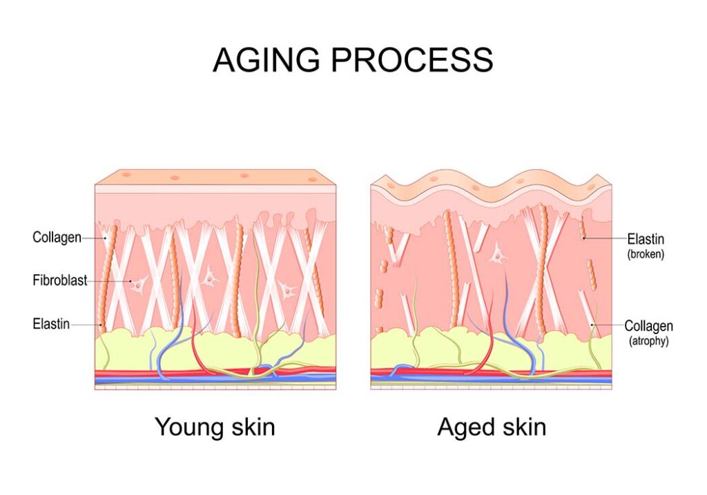 Lack of collagen leads to skin aging