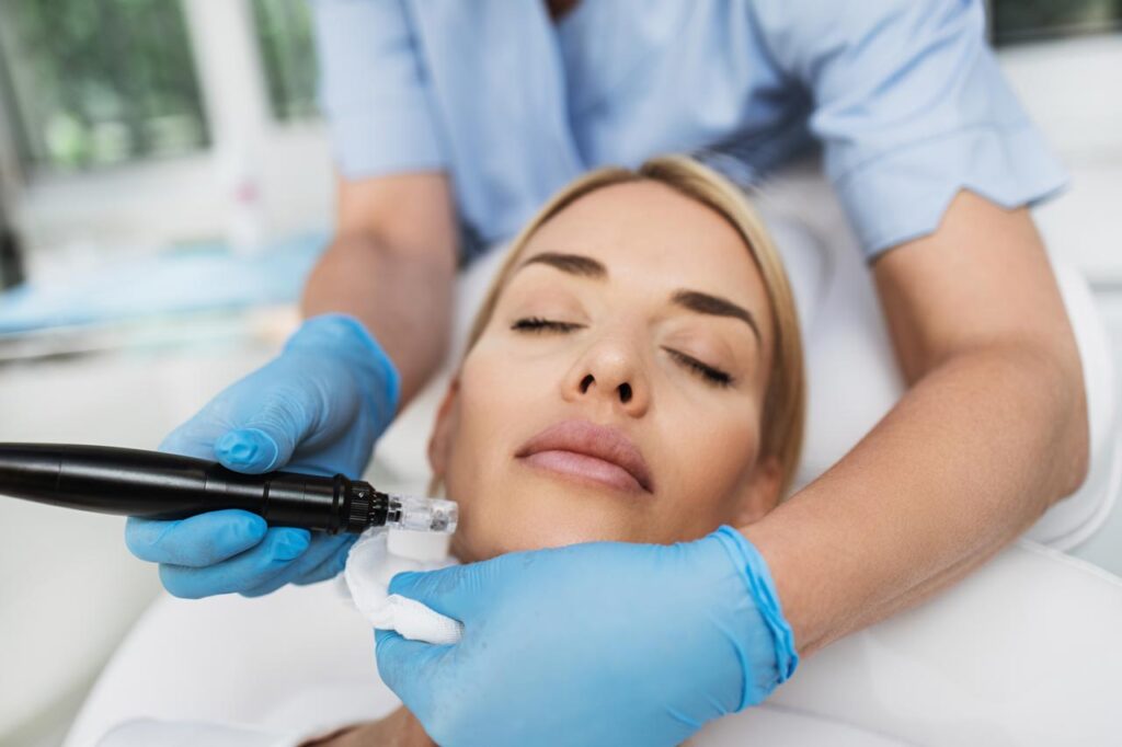 What is Microneedling with PRP