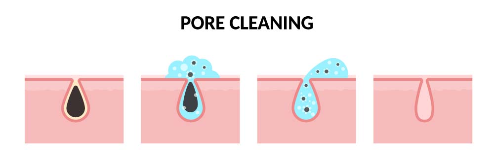 Scheme of the procedure for deep cleansing of pores