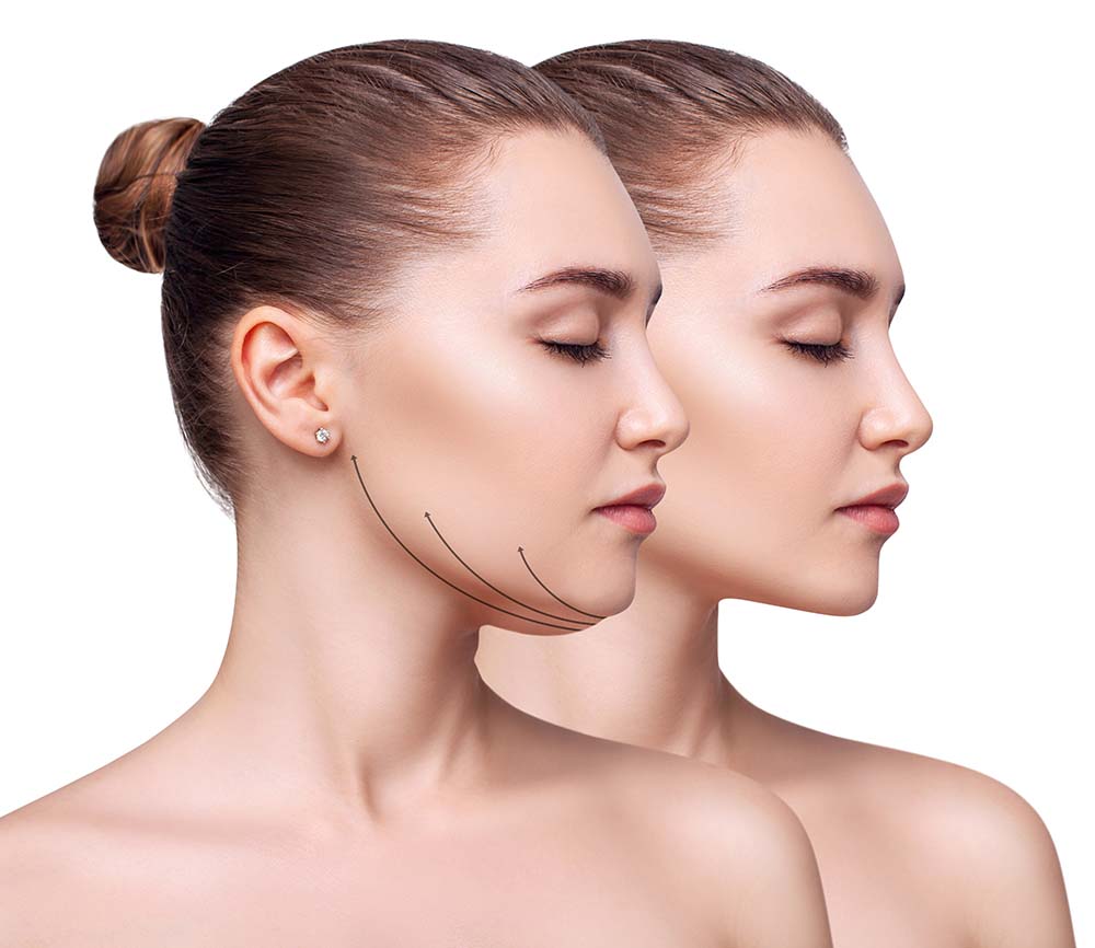 Your chin may sag even if you’re not overweight