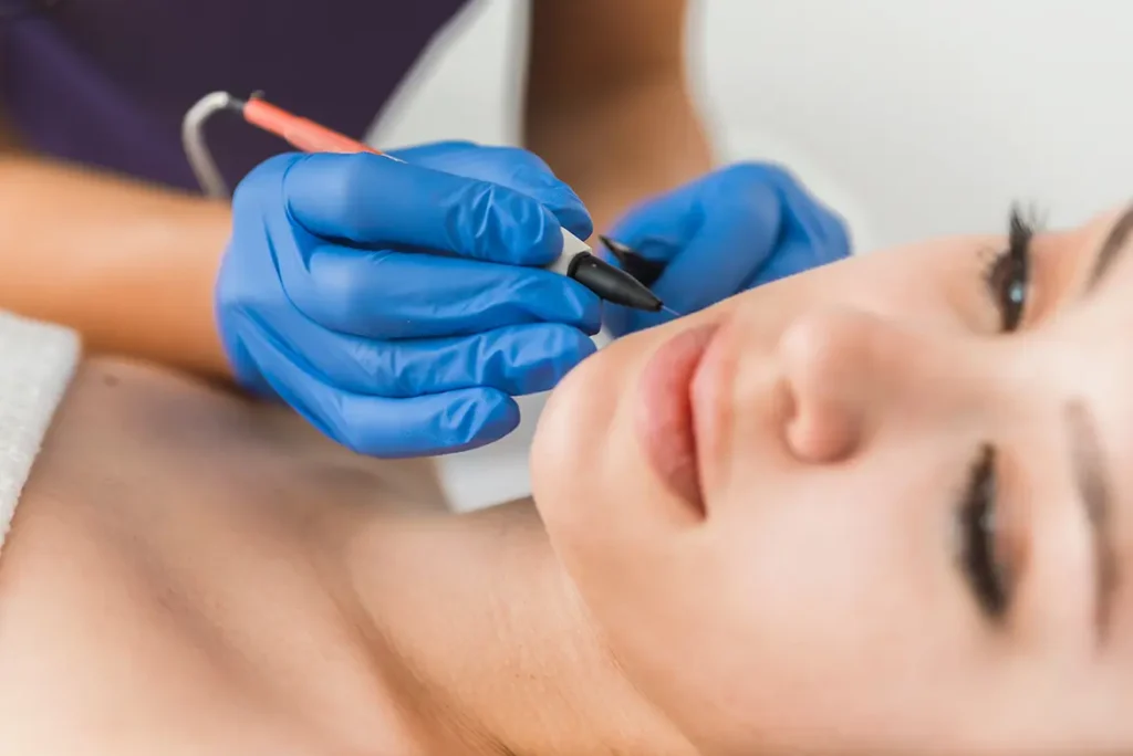 electrolysis procedure