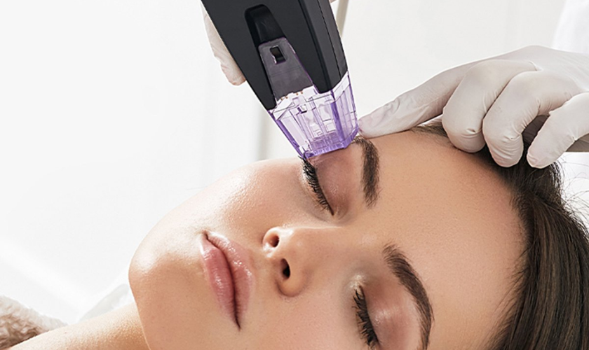 Morpheus8 treatment miami fl