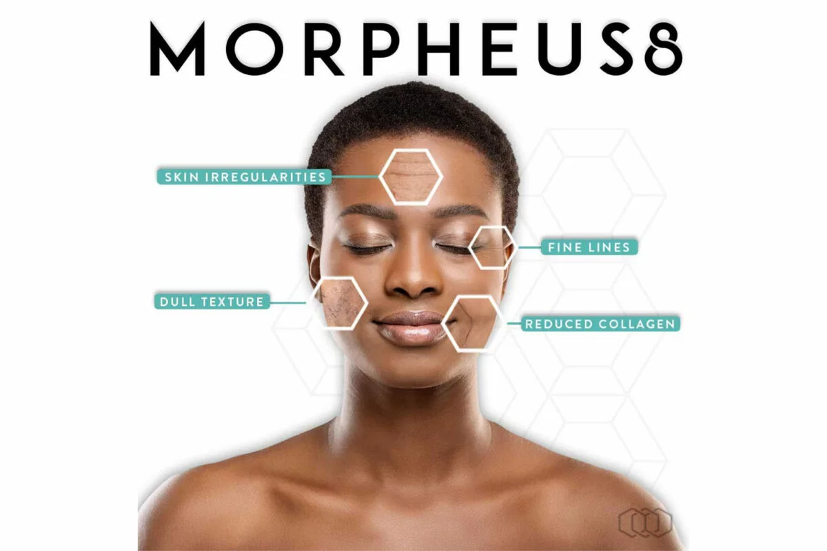 Morpheus8 with Rejuran in Miami Beach, FL