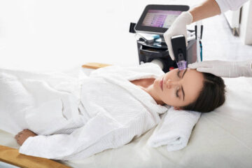 Morpheus 8 for under eyes in Miami