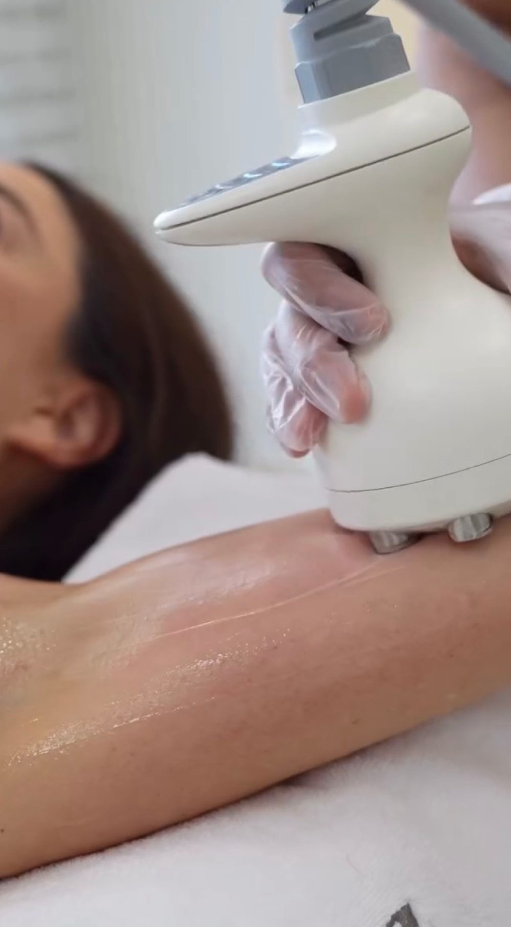 Arms Tightening Treatment - $59 - 3