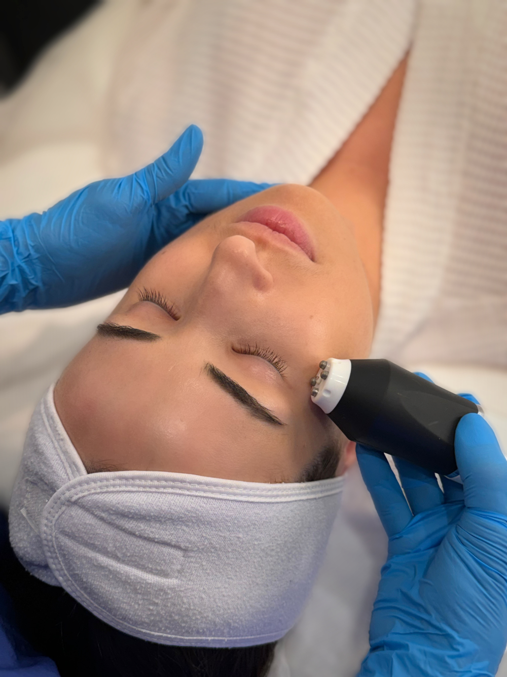 Eye Bags & Under-Eye Puffiness Treatment - $59​ - 3