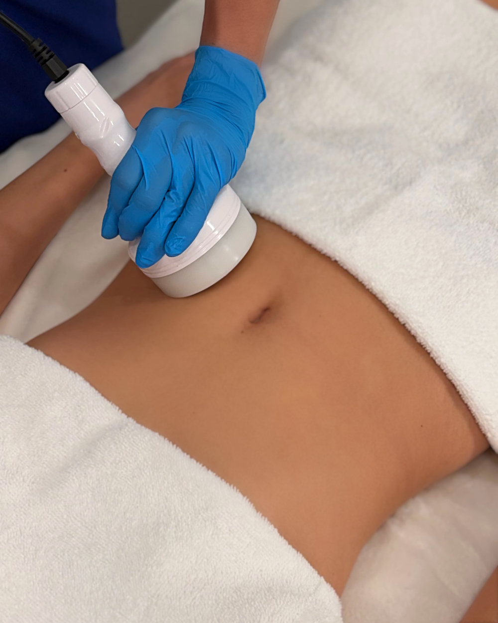 Lipo Cavitation Body Contouring Treatment - $59 - 3