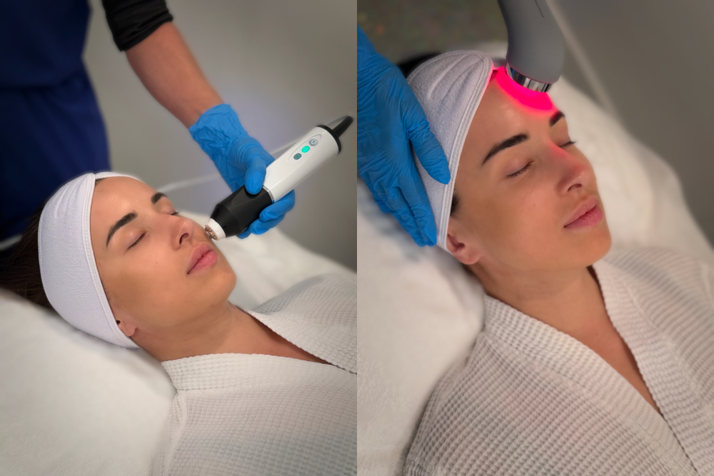 Non-Surgical Facelift Treatment - $59 - 3