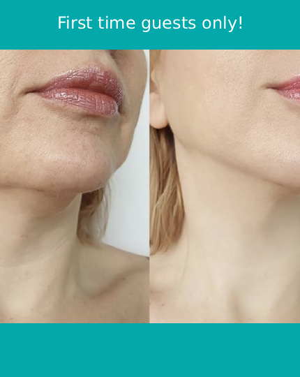 Non-Surgical-Facelift-Treatment-59_-tile (1)